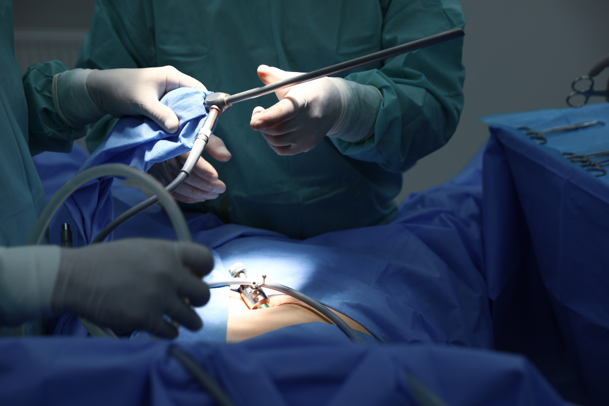 Laparoscopy – minimally invasive gynaecological surgery